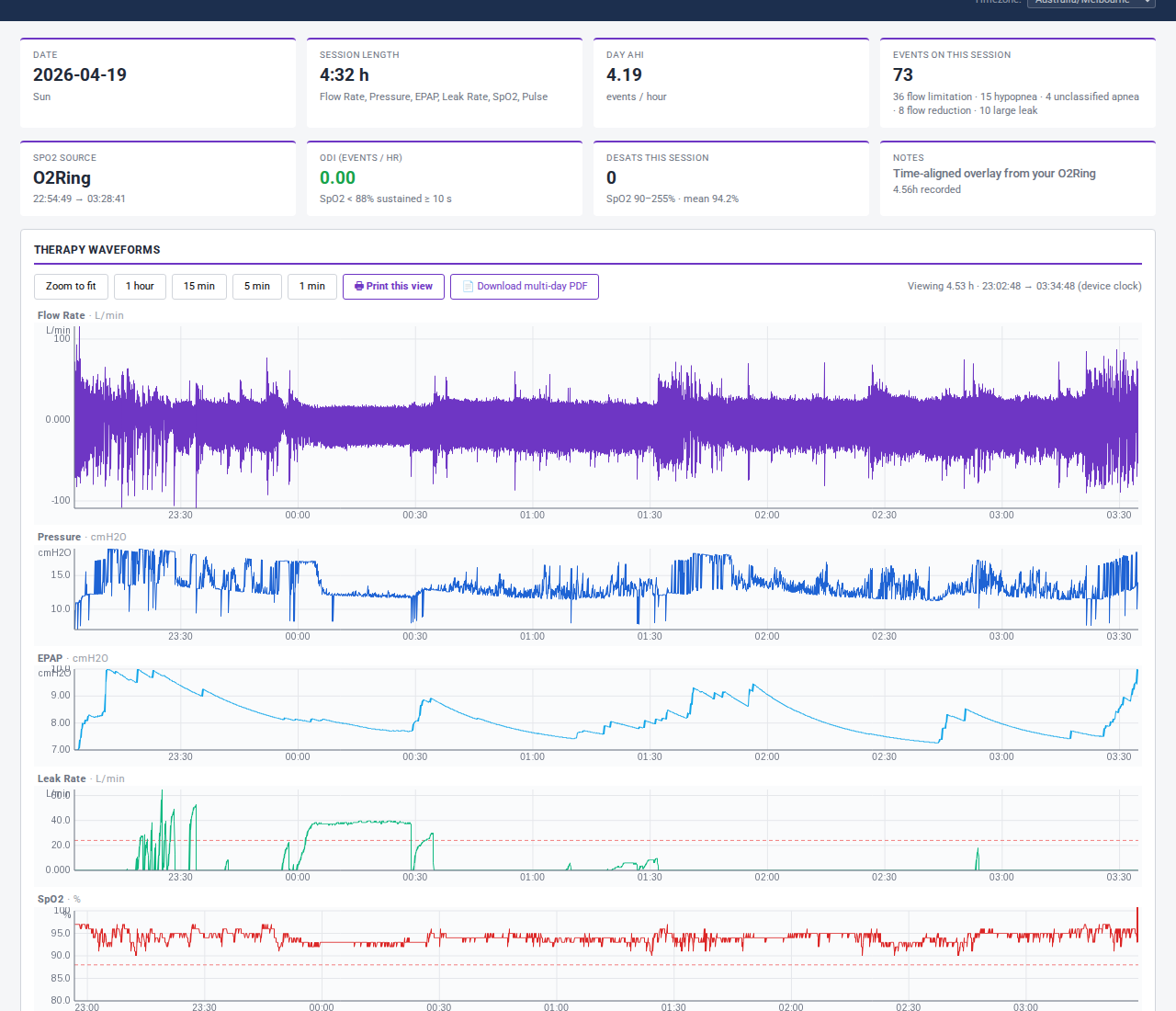 Per-night detail screenshot showing six synchronized waveform panes: flow rate, mask pressure, EPAP, leak, SpO2, pulse, over an 8-hour session